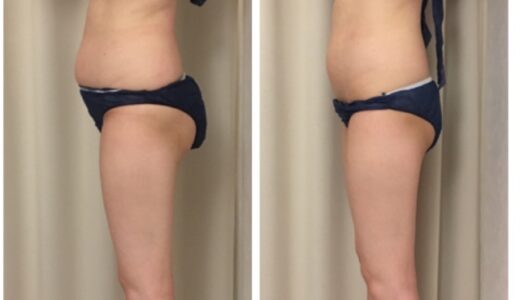 奇跡の1回を見せるだけで信頼感UP！〇〇写真のスゴイ効果